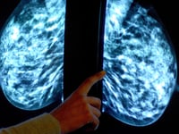 Breast screening uptake in Cornwall remains below pre-pandemic levels