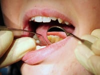 Nearly half of people in Cornwall and the Isles of Scilly struggle to get an NHS dentist appointment