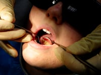A third of children have rotting teeth in Cornwall