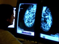 More women in Cornwall undergo breast cancer screening – as NHS England target met for first in five years