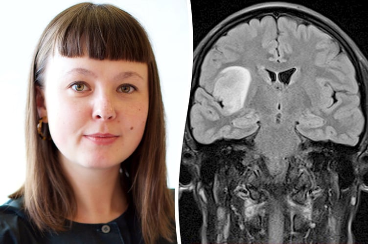 Leah Jensen, 35, documented her health journey in a stitched fabric journal that she's now due to exhibit - The show is called 'Brain Tumour Book - Artist Leah Jensenâs Journey Through Cancer Diagnosis to Treatment. // A woman who put her headaches down to "tiredness" was diagnosed with brain cancer - after she forgot how to talk. Leah Jensen, 35, had always struggled with headaches and a bad memory, but didn't think much of her symptoms. In 2020, the sculptor and ceramicist suffered a migraine while working a shift at a South East London pub, before she began to lose her vision. After Leah became confused and unable to understand what people were saying to her, an ambulance was called and she was rushed to hospital. Leah underwent eight months of tests before being diagnosed with grade three brain cancer, and undergoing life-saving surgery to get the tumour removed.