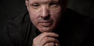 Truro victim fights "normalisation" of acid attacks
