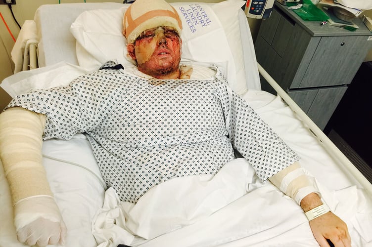 Andreas Christopheros pictured shortly after the attack in hospital (Picture provided by LegalExpert.co.uk)